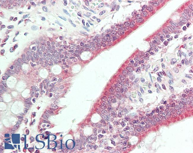 Anti-BMP6 antibody IHC staining of human small intestine. Immunohistochemistry of formalin-fixed, paraffin-embedded tissue after heat-induced antigen retrieval. Antibody LS-B11405 concentration 20 ug/ml.