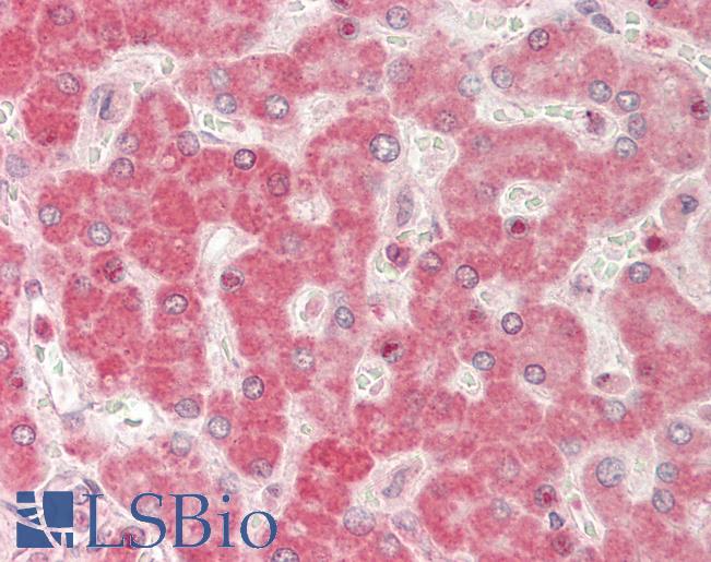 Human Liver: Formalin-Fixed, Paraffin-Embedded (FFPE)