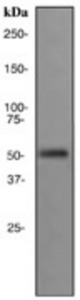 Western blot analysis on prostate cancer cell lysate using anti- Prostatic Acid Phosphatase antibody.