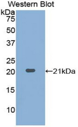 Western blot of recombinant ACPP / PAP.