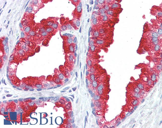 Anti-Prostatic Acid Phosphatase antibody IHC of human prostate. Immunohistochemistry of formalin-fixed, paraffin-embedded tissue after heat-induced antigen retrieval. Antibody LS-B3108 concentration 5 ug/ml.