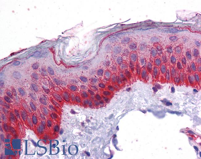 Anti-BMP7 antibody IHC of human skin. Immunohistochemistry of formalin-fixed, paraffin-embedded tissue after heat-induced antigen retrieval. Antibody LS-B4567 concentration 5 ug/ml.