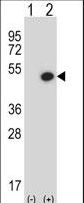 Western blot of BMP7 (arrow) using rabbit polyclonal BMP7 Antibody. 293 cell lysates (2 ug/lane) either nontransfected (Lane 1) or transiently transfected (Lane 2) with the BMP7 gene.