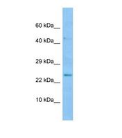 Western blot of Human 293T. BMP8A antibody dilution 1.0 ug/ml.