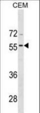 BMP8A Antibody western blot of CEM cell line lysates (35 ug/lane). The BMP8A antibody detected the BMP8A protein (arrow).