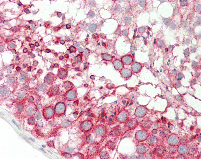 Human Testis: Formalin-Fixed, Paraffin-Embedded (FFPE)