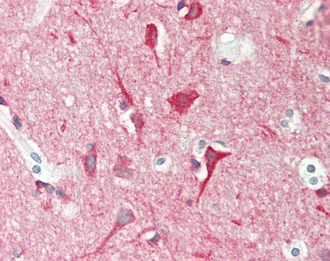Human Brain, Cortex: Formalin-Fixed, Paraffin-Embedded (FFPE)