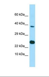 Western blot of NCI-H226. EBNA1BP2 antibody dilution 1.0 ug/ml.