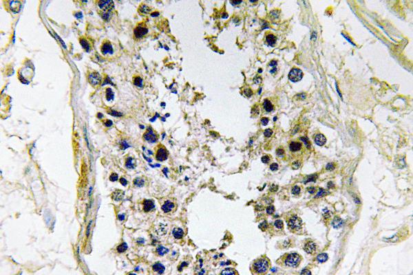 IHC of BMP-8 (E90) pAb in paraffin-embedded human testis tissue.