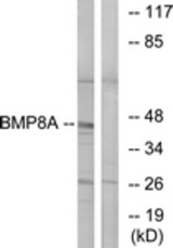 Western blot of extracts from COLO cells, using BMP8A Antibody. The lane on the right is treated with the synthesized peptide.