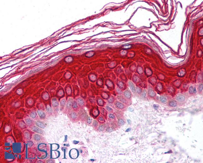Anti-BMP8B antibody IHC of human skin. Immunohistochemistry of formalin-fixed, paraffin-embedded tissue after heat-induced antigen retrieval. Antibody LS-B790 concentration 5 ug/ml.