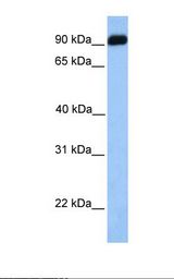 Fetal heart lysate. Antibody concentration: 1.0 ug/ml. Gel concentration: 12%.