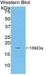 Western blot of recombinant BMPR-II / BMPR2.