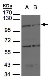Sample (30 ug of whole cell lysate). A: H1299, B: Raji . 7.5% SDS PAGE. BMPR-II / BMPR2 antibody diluted at 1:1000