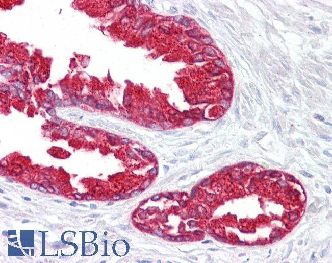 Anti-Prostatic Acid Phosphatase antibody IHC of human prostate. Immunohistochemistry of formalin-fixed, paraffin-embedded tissue after heat-induced antigen retrieval. Antibody LS-B6920 concentration 10 ug/ml.