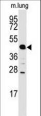 Western blot of anti-ACPP Antibody in mouse lung tissue lysates (35 ug/lane). ACPP(arrow) was detected using the purified antibody.