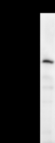 Detection of human BMS1L by Western blot. Samples: Whole cell lysate (25 ug) from HeLa cells. Predicted molecular weight: 145 kDa