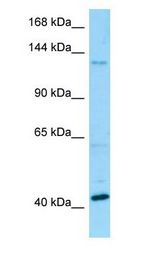 BMS1 antibody Western Blot of Fetal Kidney.
