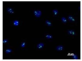 Immunofluorescent staining using BMS1L antibody. Immunostaining analysis in HeLa cells. HeLa cells were fixed with 4% paraformaldehyde and permeabilized with 0.01% Triton-X100 in PBS. The cells were immunostained with anti-BMS1L antibody. Nuclear was stained with Hoescht (blue fluorescence).