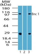 Western blot of Bnc 1 in human spleen lysate in the 1) absence and 2) presence of immunizing peptide, and3) rat lysate using LS-C148349 at 7 ug/ml and 4 ug/ml, respectively.