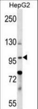 BNC1 Antibody western blot of HepG2 cell line lysates (35 ug/lane). The BNC1 antibody detected the BNC1 protein (arrow).