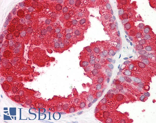 Anti-ACPP antibody IHC of human prostate. Immunohistochemistry of formalin-fixed, paraffin-embedded tissue after heat-induced antigen retrieval. Antibody LS-B8361 dilution 3.75 ug/ml.