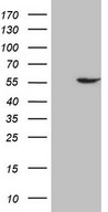 HEK293T cells were transfected with the pCMV6-ENTRY control (Left lane) or pCMV6-ENTRY ABAT (Right lane) cDNA for 48 hrs and lysed. Equivalent amounts of cell lysates (5 ug per lane) were separated by SDS-PAGE and immunoblotted with anti-ABAT.