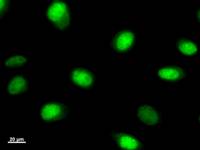 Immunostaining analysis in HeLa cells. HeLa cells were fixed with 4% paraformaldehyde and permeabilized with 0.1% Triton X-100 in PBS. The cells were immunostained with anti-BNC2 mAb.