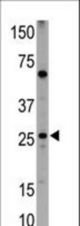 Western blot of anti-NIP1 BH3 Domain antibody in HL60 cell lysates (35 ug/lane). NIP1 BH3 Domain (arrow) was detected using the purified antibody.