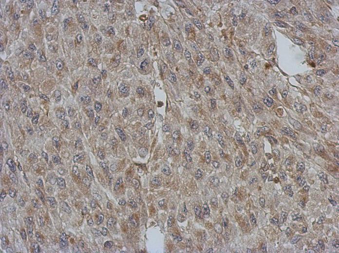 IHC of paraffin-embedded U87 xenograft, using BNIP2 antibody at 1:500 dilution.