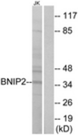 Western blot of extracts from Jurkat cells, using BNIP2 Antibody. The lane on the right is treated with the synthesized peptide.