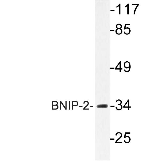 Western blot of BNIP-2 (E122) pAb in extracts from Jurkat cells.