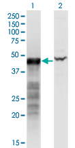 Western Blot analysis of BNIP2 expression in transfected 293T cell line by BNIP2 monoclonal antibody (M02), clone 8C6.Lane 1: BNIP2 transfected lysate (Predicted MW: 36 KDa).Lane 2: Non-transfected lysate.