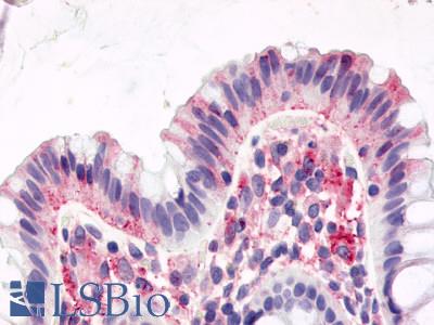 Anti-GPR15 antibody LS-A1613 IHC of human colon, surface epithelium. Immunohistochemistry of formalin-fixed, paraffin-embedded tissue after heat-induced antigen retrieval.