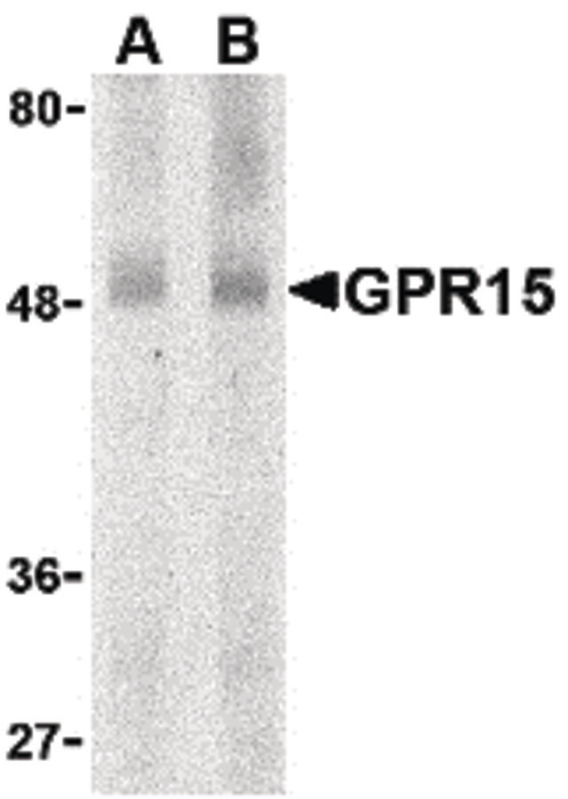 Western blot of GPR15 in human spleen lysate with GPR15 antibody at (A) 0.5 and (B) 1 ug/ml.