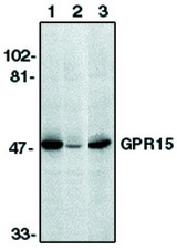 Western blot of GPR15 antibody on human heart lysate in the absence (1) and presence (2) of specific blocking peptide and a non-related peptide (3).