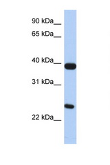 GPR15 antibody LS-C112303 Western blot of Small Intestine lysate. Antibody concentration 1 ug/ml.