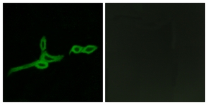 Immunofluorescence of LOVO cells, using GPR15 Antibody. The picture on the right is treated with the synthesized peptide.