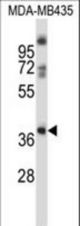 GPR15 Antibody western blot of MDA-MB435 cell line lysates (35 ug/lane). The GPR15 antibody detected the GPR15 protein (arrow).