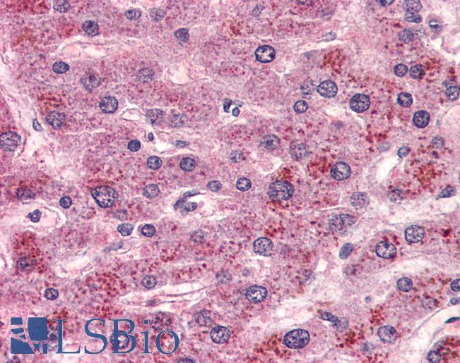 Anti-GPR15 antibody LS-A1615 IHC of human liver. Immunohistochemistry of formalin-fixed, paraffin-embedded tissue after heat-induced antigen retrieval.
