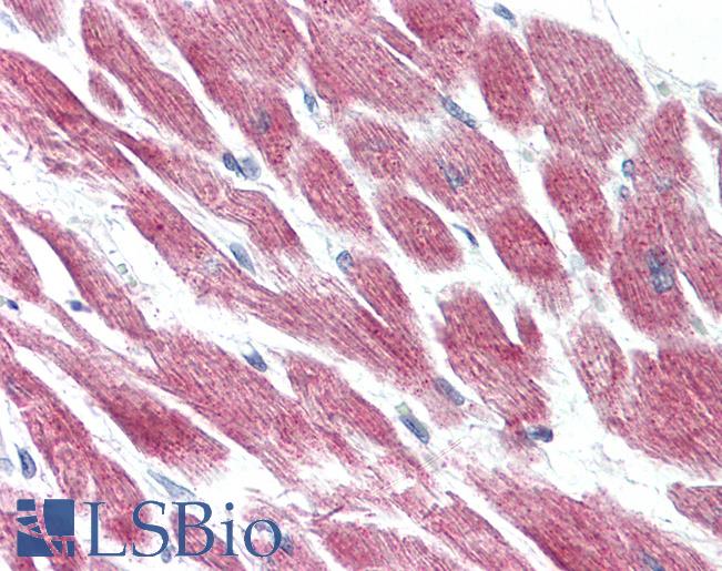 Anti-GPR15 antibody LS-A1615 IHC of human heart. Immunohistochemistry of formalin-fixed, paraffin-embedded tissue after heat-induced antigen retrieval.