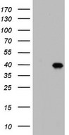 HEK293T cells were transfected with the pCMV6-ENTRY control (Left lane) or pCMV6-ENTRY BOLL (Right lane) cDNA for 48 hrs and lysed. Equivalent amounts of cell lysates (5 ug per lane) were separated by SDS-PAGE and immunoblotted with anti-BOLL.