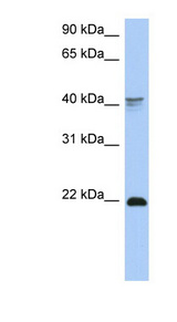 DLX4 antibody LS-C110240 Western blot of COLO205 cell lysate.