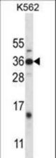 DLX4 Antibody western blot of K562 cell line lysates (35 ug/lane). The DLX4 antibody detected the DLX4 protein (arrow).