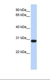 Fetal heart lysate. Antibody concentration: 1.0 ug/ml. Gel concentration: 12%.