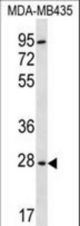 BPGM Antibody western blot of MDA-MB435 cell line lysates (35 ug/lane). The BPGM antibody detected the BPGM protein (arrow).