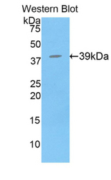 Western blot of recombinant BPI.