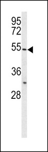 Western blot of BPI Antibody in HL-60 cell line lysates (35 ug/lane). BPI (arrow) was detected using the purified antibody.