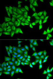 Immunofluorescence analysis of A549 cell using BPI antibody. Blue: DAPI for nuclear staining.