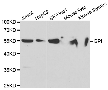 Western blot analysis of extracts of various cell lines, using BPI antibody.